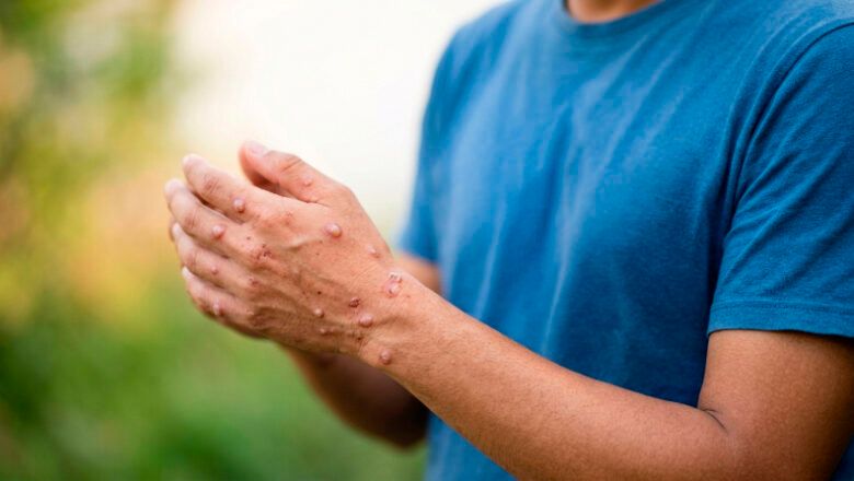 Colombia fortalece acciones de vigilancia epidemiológica, identificación por laboratorio y prevención mediante la vacunación
